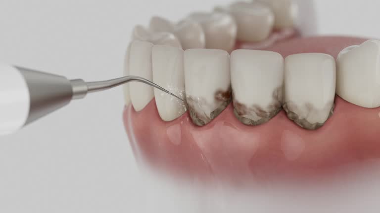 Reliable Tooth Extraction contractor in Constantine, MI by Smile Center Dentistry